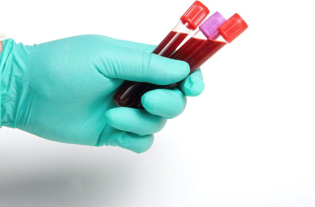 Centro trasfusionale di San Gavino, test sierologico gratuito per i donatori di sangue